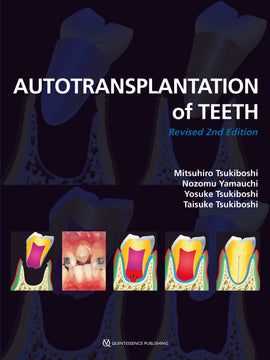 Autotransplantation of Teeth