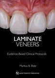 Laminate Veneers