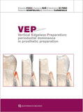 VEP Vertical Edgeless Preparation