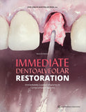 Immediate Dentoalveolar Restoration, 2nd Edition